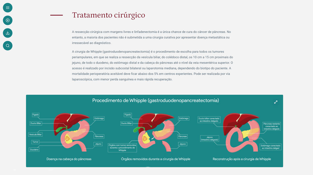 Surgclass Materials